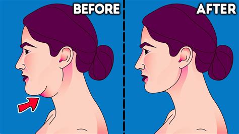 Follow These Simple Exercises To Get A Perfect Jawline | atelier-yuwa ...