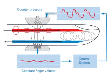 Cnap Lidco Hemodynamic Monitoring For The Entire Patient Pathway