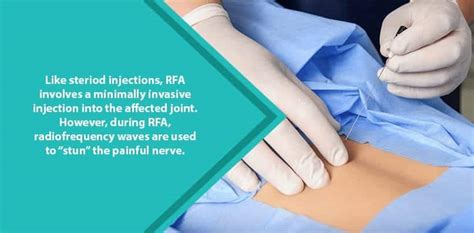 Radiofrequency Ablation for Nerve Pain | NJ Spine & Ortho