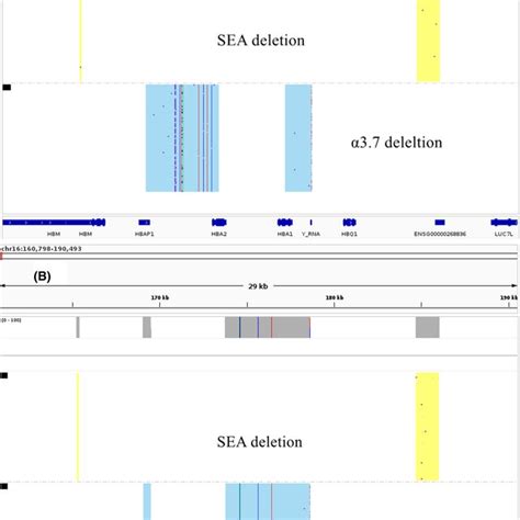 Integrative Genomics Viewer Igv Plots Of Common Deletional Hb H