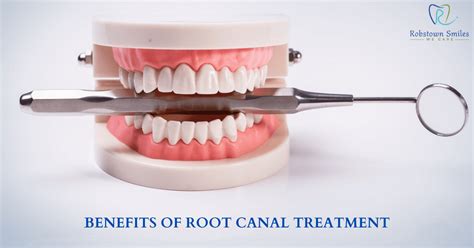 Top Benefits Of Root Canal Treatment Robstown Smiles