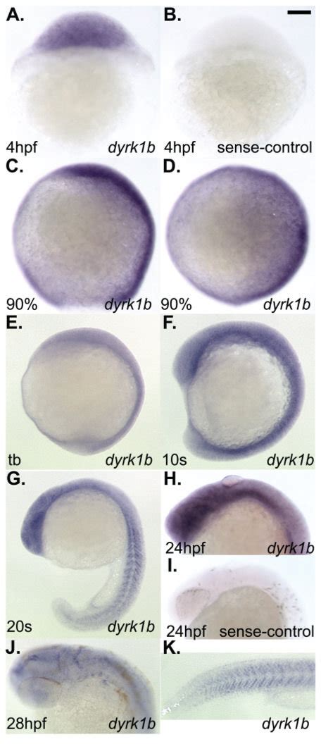 Whole Mount In Situ Hybridization Analysis Of Dyrk1b Expression In