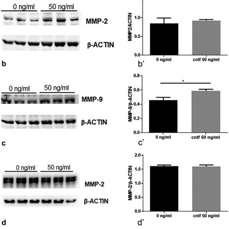 Mmp 1 Expression Is Mediated By The Mapkerk Pathway Whereas Mmp 9 Download Scientific Diagram