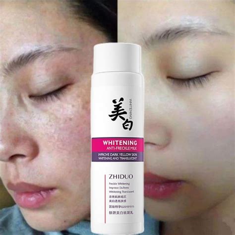 Fsix👍whitening Freckle Removing Lotion Cream Body Facial Lotion