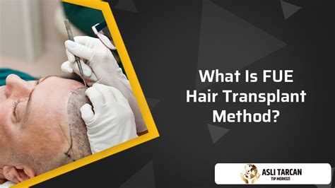 What Is FUE Hair Transplant Method? | Asli Tarcan Clinic