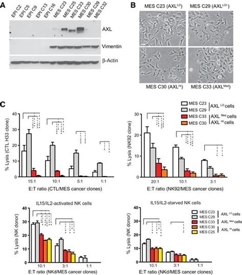 Axl Targeting Overcomes Human Lung Cancer Cell Resistance To Nk And