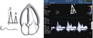 Curso de Ecocardiografía básica en Pediatría Niakoro