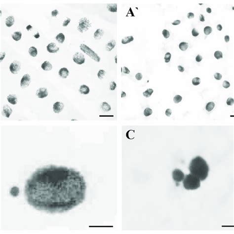 Cytological Effects Of Al In Root Cells Of Barley Seedlings Cv