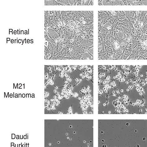 Staurosporine Does Not Induce Neurite Formation In Other Retinal And