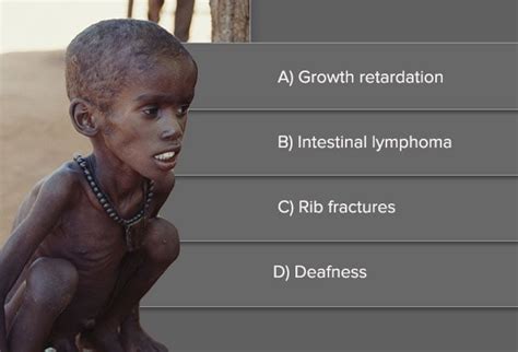 Malnutrition: Causes, Complications, and Treatments