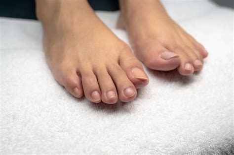 Processos e detalhes da pedicure clínica dos pés das mulheres 039 pés