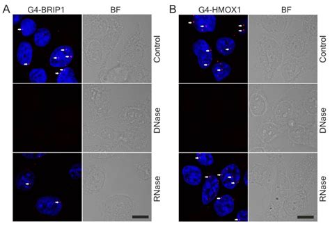 Proximity Ligation Assay Detection Of Protein Dna Interactions Is There