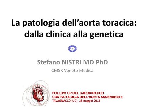 Ppt La Patologia Dellaorta Toracica Dalla Clinica Alla Genetica