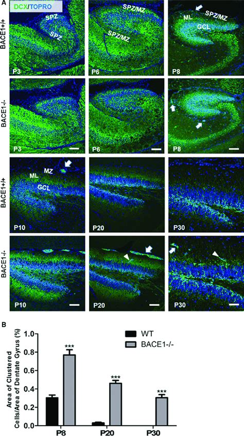 Expression Of Dcx Clusters In The Dentate Gyrus During Mouse