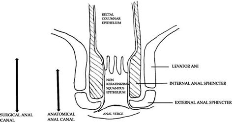 Fissure In Ano Intechopen