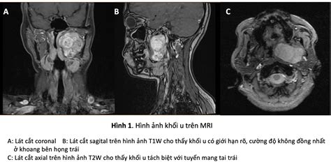 Ảnh Hình Khối Khám Phá Thế Giới 3d Đầy Màu Sắc Và Sáng Tạo