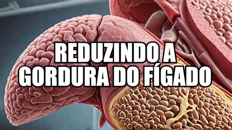 Suplementação para reduzir GORDURA NO FÍGADO e ou GORDURA VISCERAL