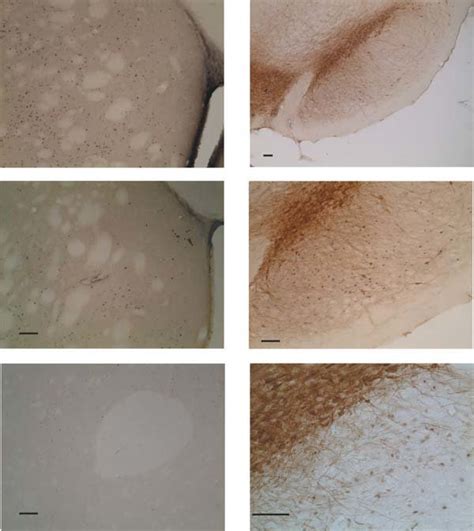 Photomicrographs Demonstrate Fos Ir Nuclei Expression In The