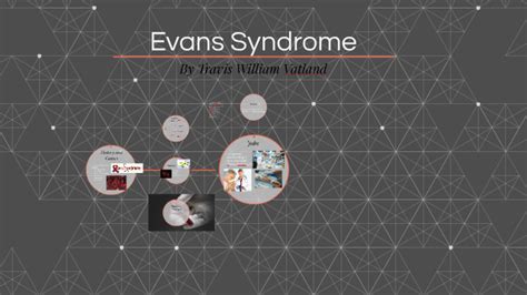 Evans Syndrome by on Prezi