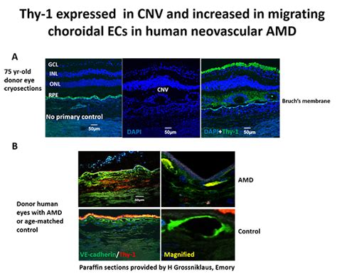 retinal pigment epithelium – Webvision