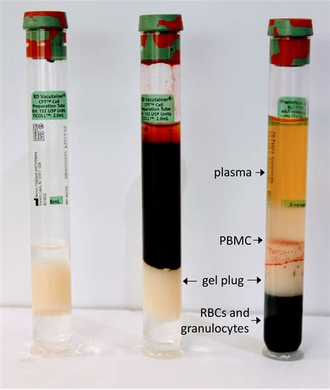 Figure Empty Cpt Left After Blood Draw Middle And After