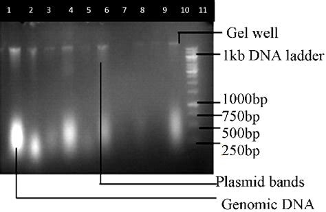 Genomic Dna Extraction On Agarose Gel Electrophoresis Download Scientific Diagram