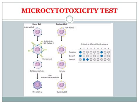 Hla Tissue Typing Hla Matching Microcytotoxicity Test Mixed