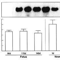 Upper Panel Representative Autoradiogram Of A Northern Blot Of Total