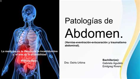 Hernias eventración evisceración y traumatismo abdominal pptx