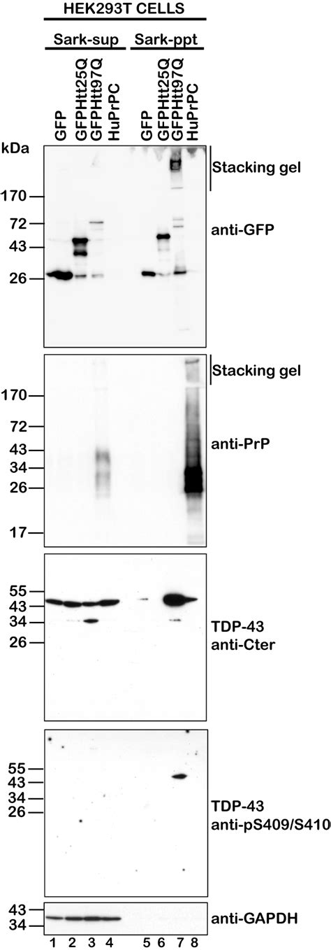 Pk Resistant Prion Protein Prp Does Not Induce Tdp Aggregation And