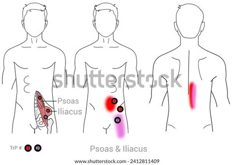 Psoas Massage Photos, Images & Pictures | Shutterstock