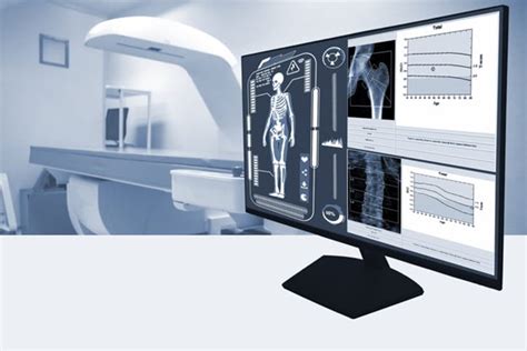 Four Different Reasons Bone Density Scans Are Important