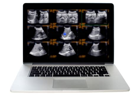 100 Fundus Of Gallbladder Photos Stock Photos Pictures And Royalty Free