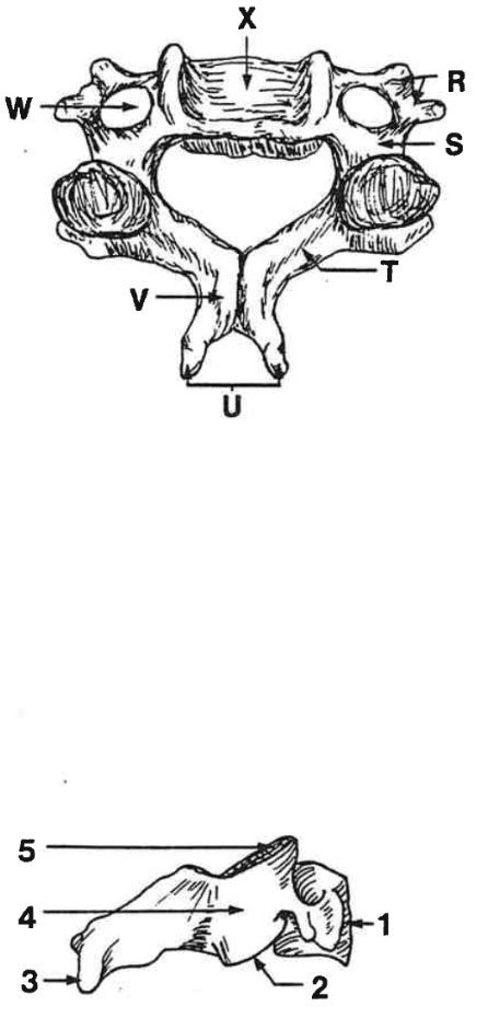 Typical Cervical Vertebrae Diagram Quizlet