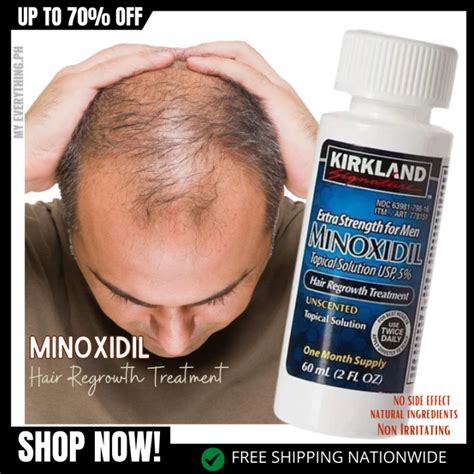 New Kirkland Minoxidil Hair Regrowth Treatment Clinically Proven To