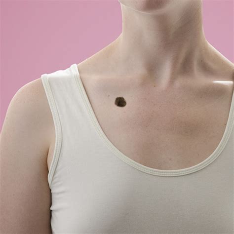 Moles On Neck Meaning