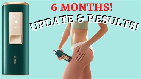 Ulike Ipl Hair Removal Device Review And 6 Months Results Update Youtube