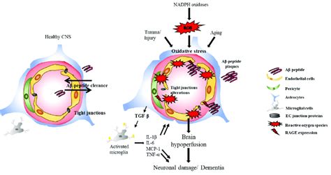 Oxidative Stress And Blood Brain Barrier BBB Breakdown Reactive