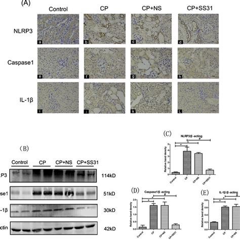 Renal Nlrp3 Il 1β And Caspase1 Expression In Cp Aki Mice Following