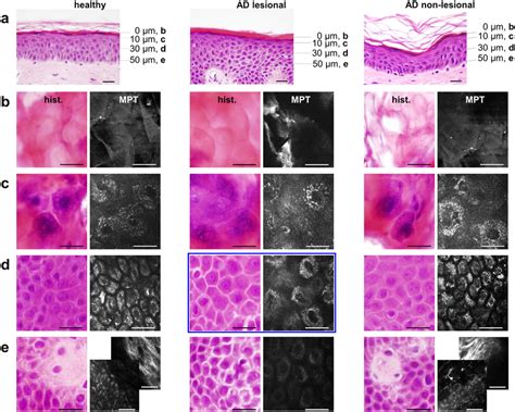 Gold Standard Alignment Of Intravital Multiphoton Tomography A