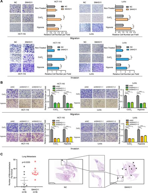 Snhg11 Promotes Hypoxia Induced Crc Cell Migration Invasion And