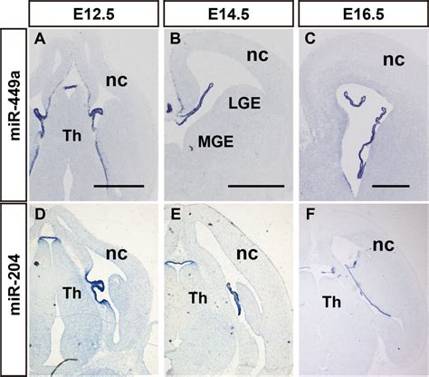 Mirnas Exhibit Choroid Plexus Enriched Expression In The Developing