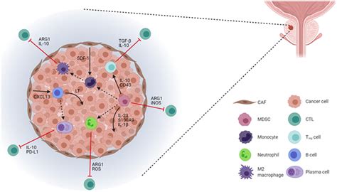 The Tumor Microenvironment And Immune Responses In Prostate Cancer