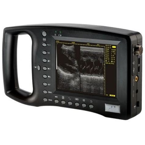 Digital Ultrasound Scanner Wed 3100 Medcorp