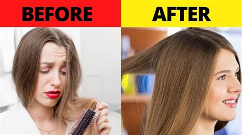 The Simplest Method For Hair Loss Can Be The Best Hair Loss Solution