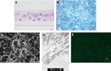 Confirmation Of Normal Human Bronchial Epithelial Cell NHBE