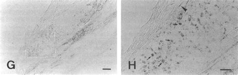 Photomicrographs Of Nadphd Histochemical Staining In Human Cerebral