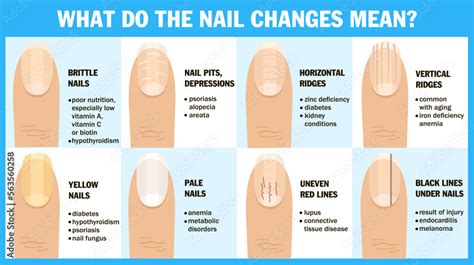 What Do The Nail Changes Mean The Appearance Of The Nail And The