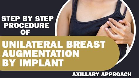 Step By Step Procedure Of Unilateral Breast Augmentation Breast