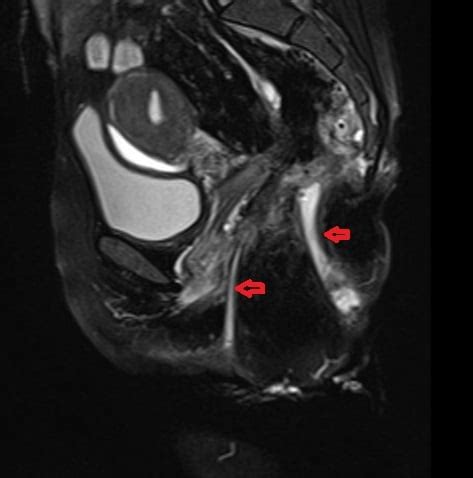 MRI Pelvis Pathologies How To Report An MRI Pelvis Scan